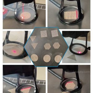 Scar & Streatch Mark Removal